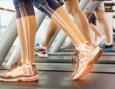 Close up of woman's legs on treadmill showing the bone outlines