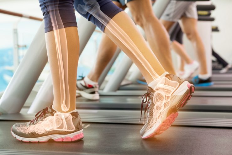 Close up of woman's legs on treadmill showing the bone outlines